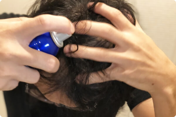 3. 育毛剤を試してみる